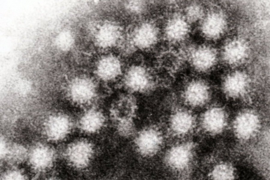 News brief: Suspected Norovirus outbreak strikes FCPS elementary school